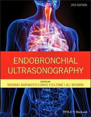 Portada del libro 9781119233947 Endobronchial Ultrasonography