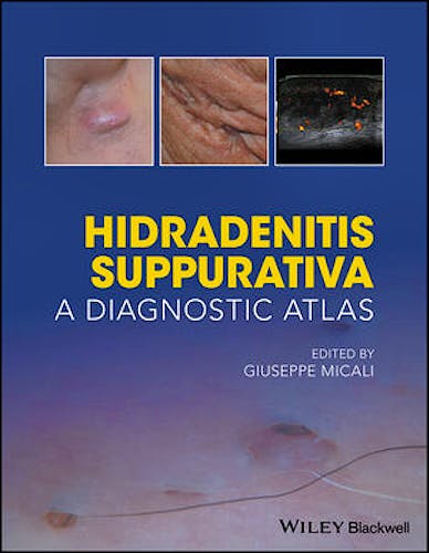 Portada del libro 9781119272953 Hidradenitis Suppurativa: A Diagnostic Atlas
