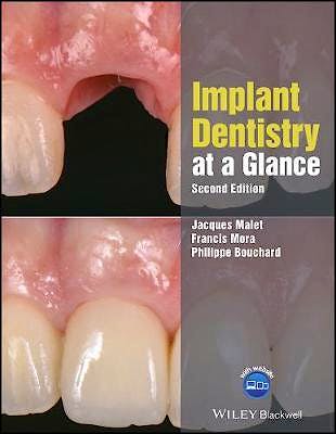 Portada del libro 9781119292609 Implant Dentistry at a Glance
