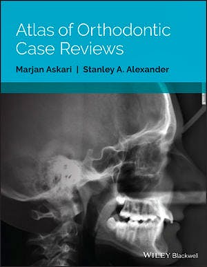 Portada del libro 9781119303756 Atlas of Orthodontic Case Reviews