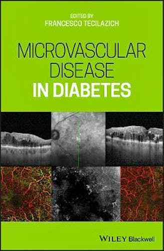 Portada del libro 9781119309604 Diabetic Microvascular Disease