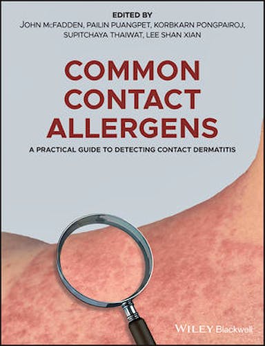 Portada del libro 9781119405665 Common Contact Allergens. A Practical Guide to Detecting Contact Dermatitis