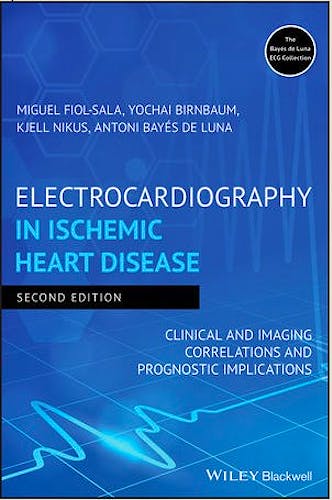 Portada del libro 9781119422662 Electrocardiography in Ischemic Heart Disease. Clinical and Imaging Correlations and Prognostic Implications