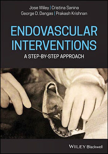 Portada del libro 9781119467786 Endovascular Interventions. A Step-by-Step Approach
