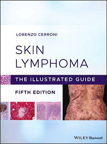 Portada del libro 9781119485902 Skin Lymphoma. The Illustrated Guide