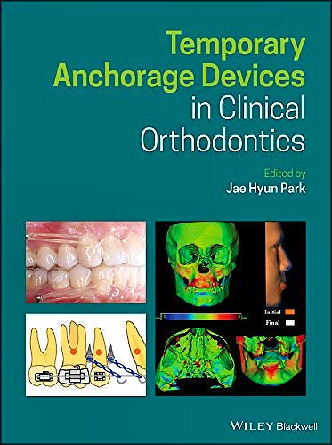 Portada del libro 9781119513476 Temporary Anchorage Devices in Clinical Orthodontics