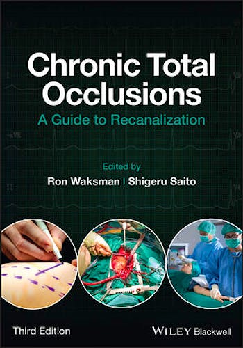 Portada del libro 9781119517276 Chronic Total Occlusions. A Guide to Recanalization