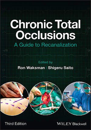 Chronic Total Occlusions. A Guide to Recanalization