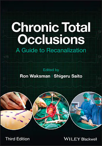 Chronic Total Occlusions. A Guide to Recanalization
