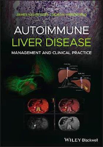Portada del libro 9781119532606 Autoimmune Liver Disease. Management and Clinical Practice