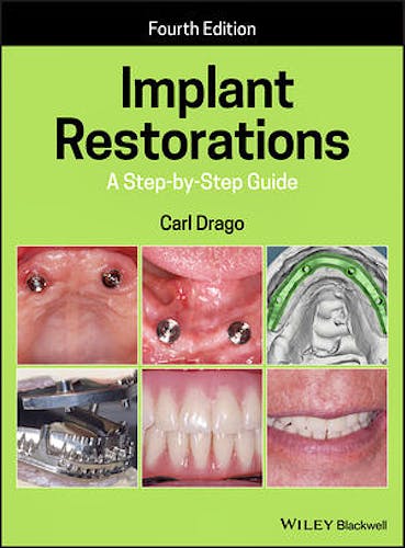 Portada del libro 9781119538110 Implant Restorations. A Step-By-Step Guide