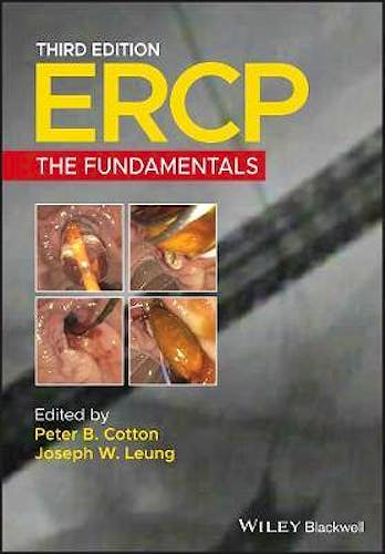 Portada del libro 9781119601098 ERCP The Fundamentals