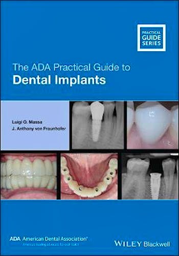 Portada del libro 9781119630692 The ADA Practical Guide to Dental Implants