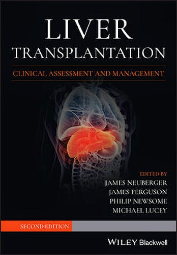 Portada del libro 9781119633983 Liver Transplantation. Clinical Assessment and Management