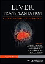 Liver Transplantation. Clinical Assessment and Management