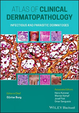 Portada del libro 9781119647065 Atlas of Clinical Dermatopathology. Infectious and Parasitic Dermatoses