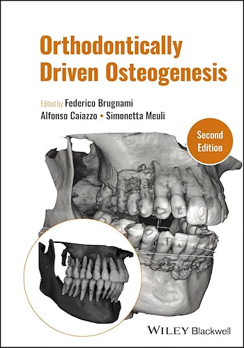 Portada del libro 9781119700562 Orthodontically Driven Osteogenesis