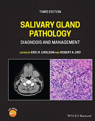 Portada del libro 9781119730187 Salivary Gland Pathology. Diagnosis and Management
