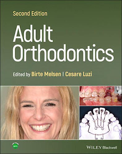 Portada del libro 9781119775775 Adult Orthodontics