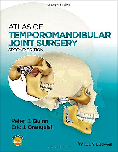 Portada del libro 9781119949855 Atlas of Temporomandibular Joint Surgery