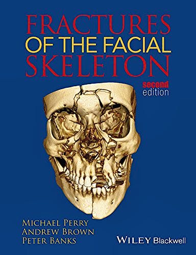 Portada del libro 9781119967668 Fractures of the Facial Skeleton