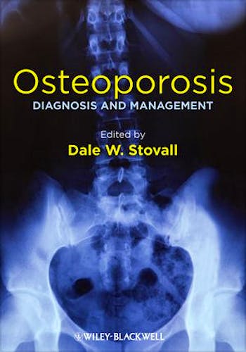 Portada del libro 9781119968917 Osteoporosis. Diagnosis and Management