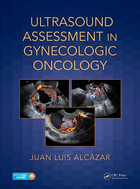Portada del libro 9781138044326 Ultrasound Assessment in Gynecologic Oncology