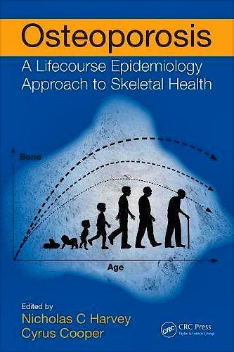 Portada del libro 9781138196162 Osteoporosis. A Lifecourse Epidemiology Approach to Skeletal Health