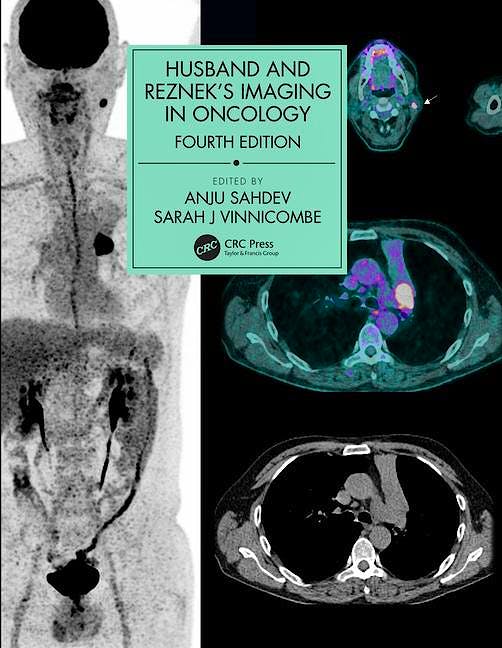 Portada del libro 9781138301238 Husband and Reznek's Imaging in Oncology