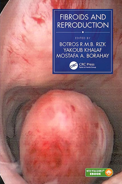 Portada del libro 9781138305427 Fibroids and Reproduction