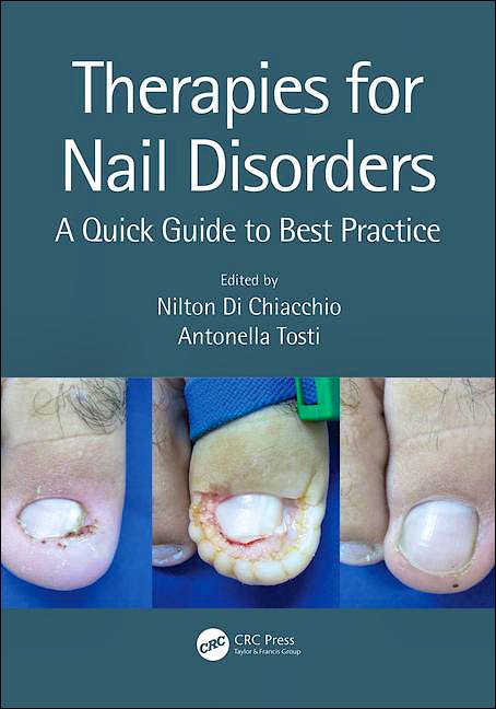 Portada del libro 9781138370364 Therapies for Nail Disorders. A Quick Guide to Best Practice