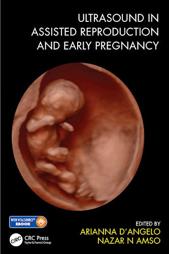 Portada del libro 9781138485853 Ultrasound in Assisted Reproduction and Early Pregnancy