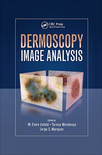 Portada del libro 9781138892873 Dermoscopy Image Analysis