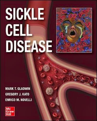 Portada del libro 9781260458596 Sickle Cell Disease