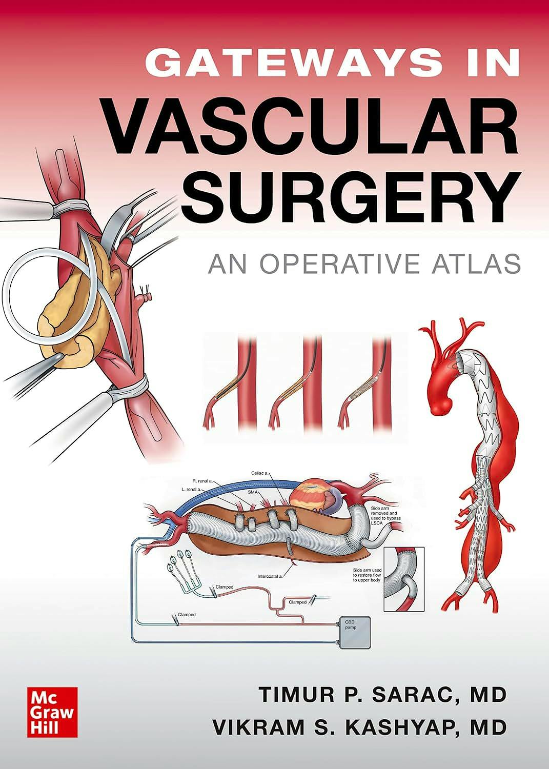 Gateways in Vascular Surgery. An Operative Atlas