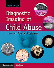 Diagnostic Imaging of Child Abuse