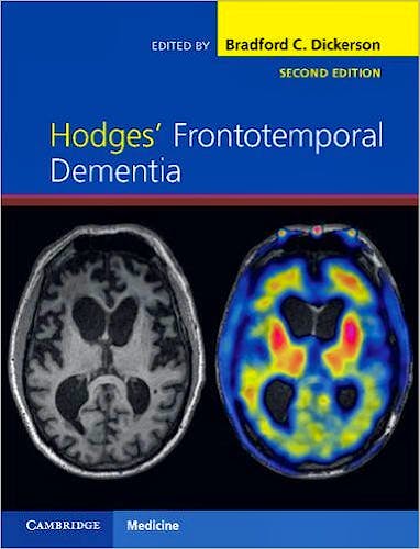 Hodges' Frontotemporal Dementia