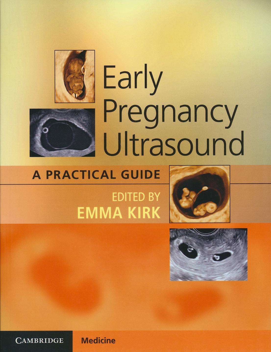 Portada del libro 9781316503867 Early Pregnancy Ultrasound. A Practical Guide