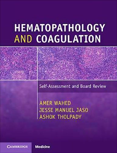 Portada del libro 9781316505601 Hematopathology and Coagulation. Self-Assessment and Board Review
