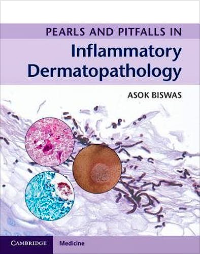 Portada del libro 9781316605998 Pearls and Pitfalls in Inflammatory Dermatopathology