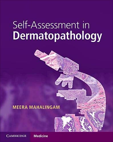 Portada del libro 9781316622872 Self-Assessment in Dermatopathology