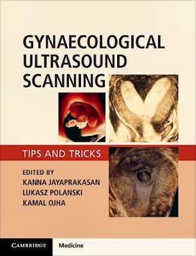 Portada del libro 9781316645178 Gynaecological Ultrasound Scanning. Tips and Tricks