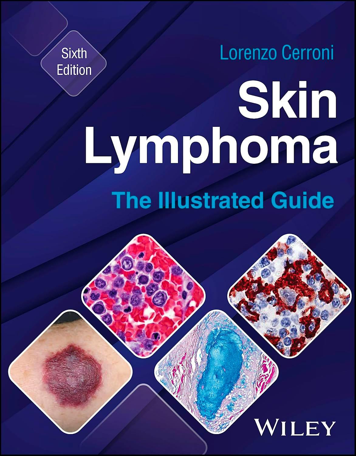 Portada del libro 9781394235483 Skin Lymphoma. The Illustrated Guide