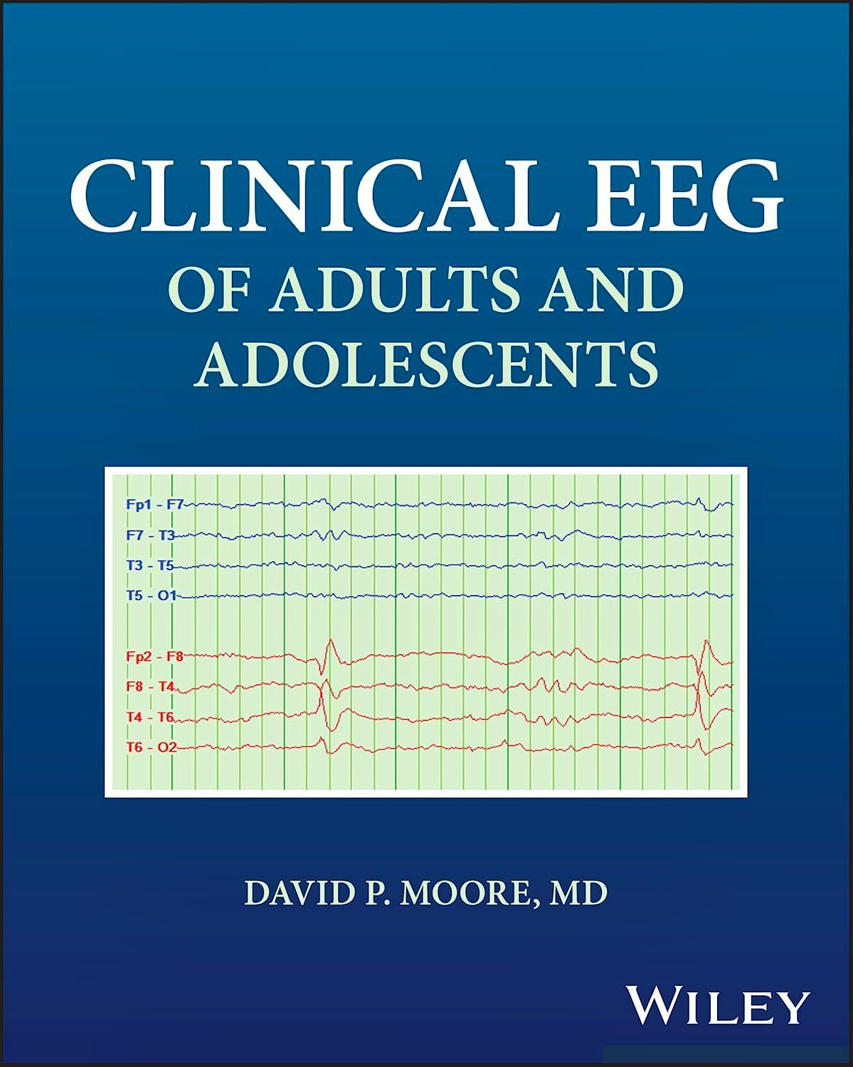 Clinical EEG of Adults and Adolescents