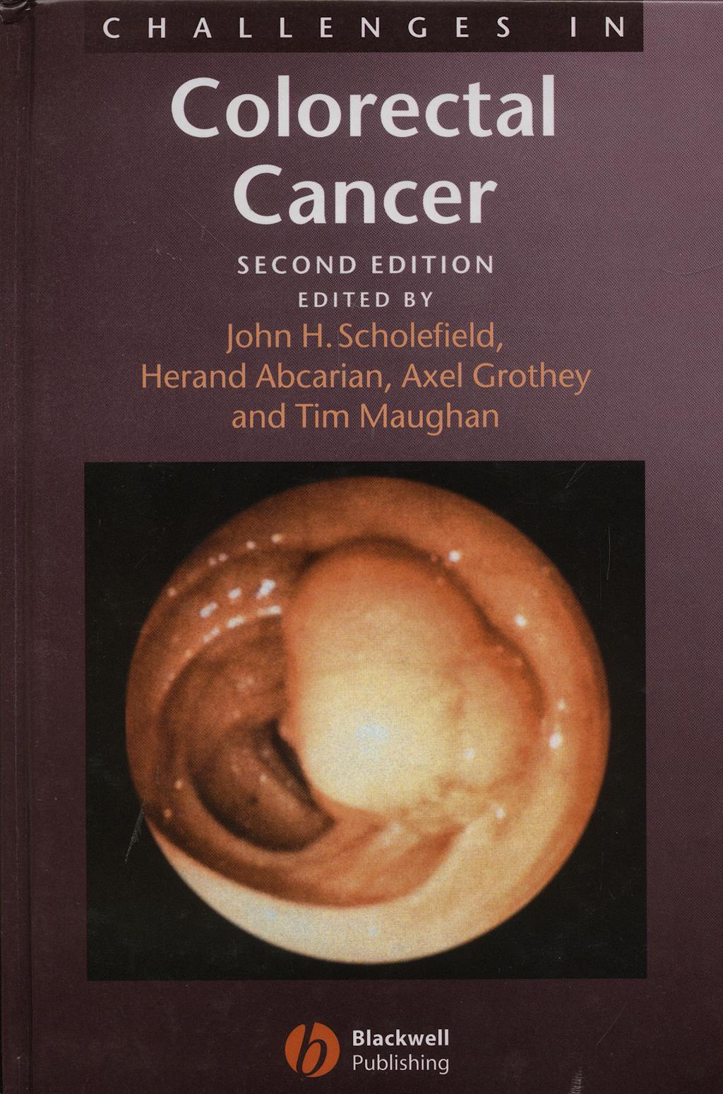 Portada del libro 9781405127066 Challenges in Colorectal Surgery