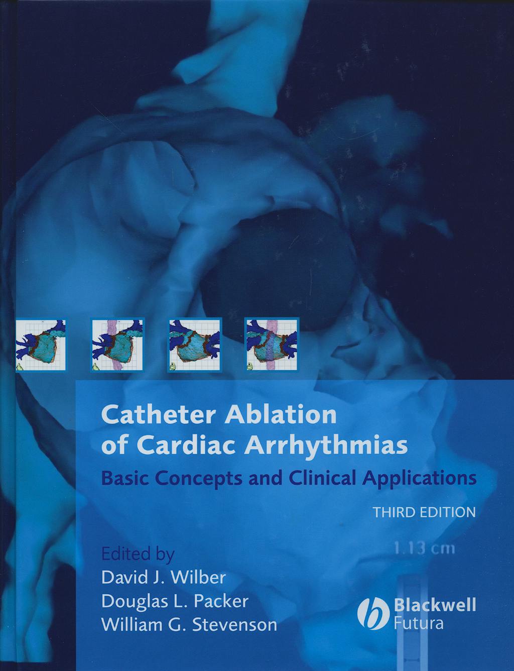Portada del libro 9781405131179 Catheter Ablation of Cardiac Arrhythmias