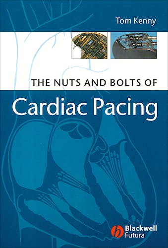 Portada del libro 9781405132978 The Nuts and Bolts of Cardiac Pacing