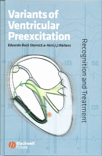 Portada del libro 9781405148436 Variants of Ventricular Preexcitation. Recognition and Treatment