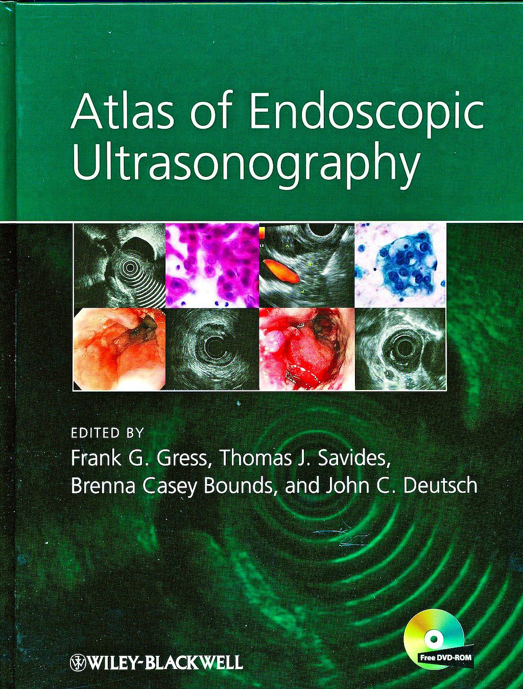 Portada del libro 9781405157216 Atlas of Endoscopic Ultrasonography + Dvd-Rom