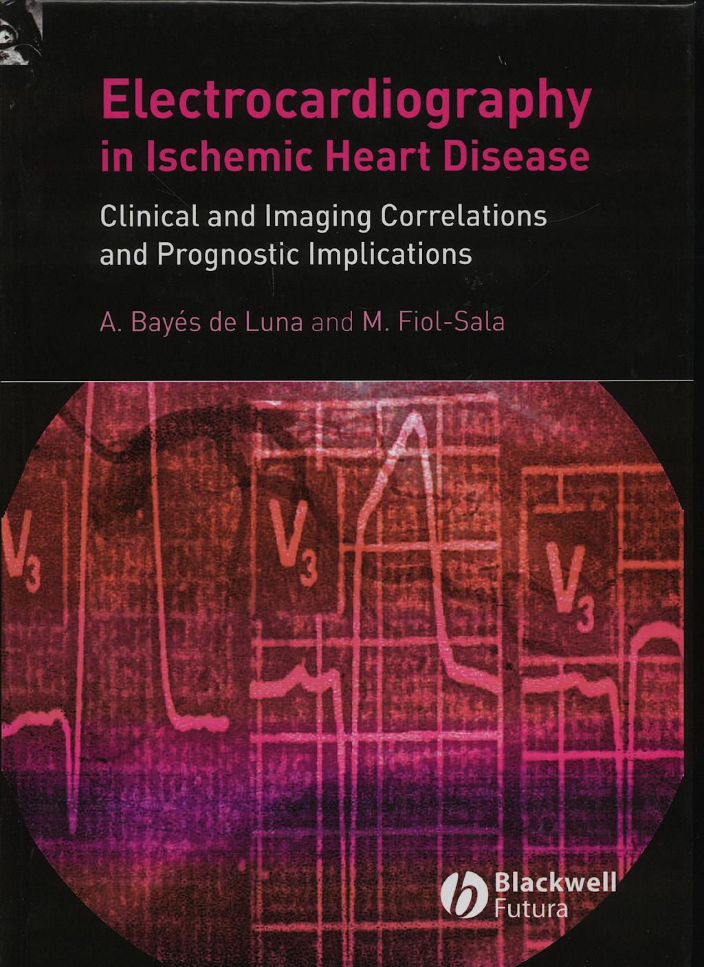 Portada del libro 9781405173629 Electrocardiograpy in Ischemic Heart Disease. Clinical and Imaging Correlations and Prognostic Implications
